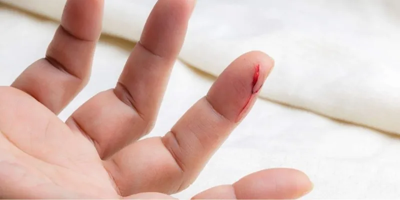 Giấc mơ thấy mất nhiều máu