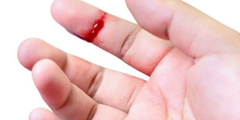 Nằm mơ thấy máu chảy nhưng không đau 