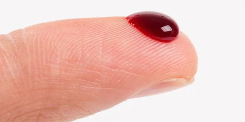 Mơ thấy máu chảy nên đánh số nào?